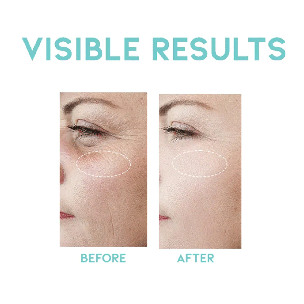 OOTD Wrinkle Lift Retinol Serum 50ml - KLO