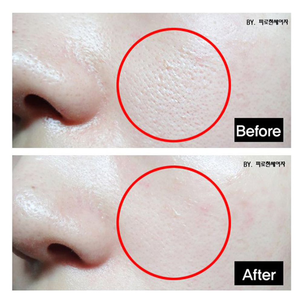 TOSOWOONG Platinum Miracle Pore Tightening Pack 150ml - KLO