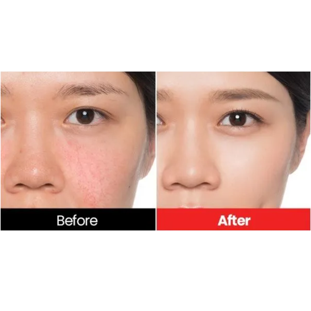 Dr.want Red Cover Cream 17g - KLO