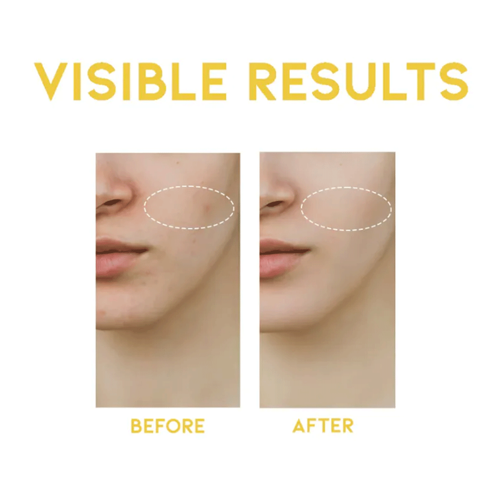 OOTD Dark Spot Vitamin C Serum 50ml - KLO