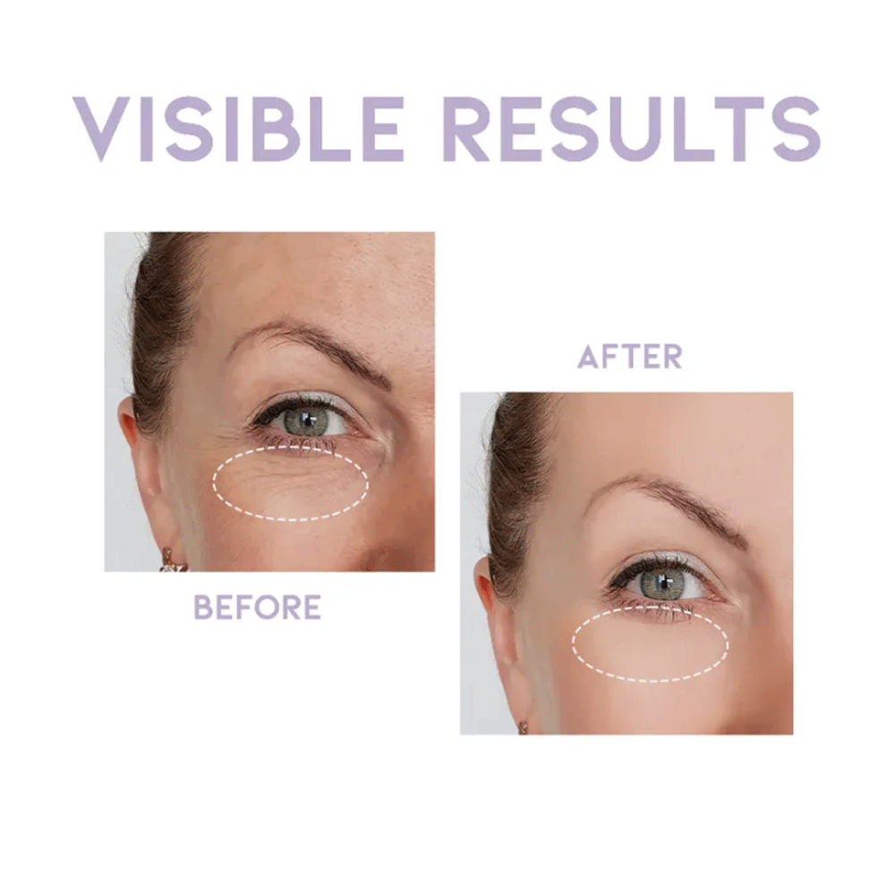 OOTD Overnight Eye Cream P.M 25g - KLO