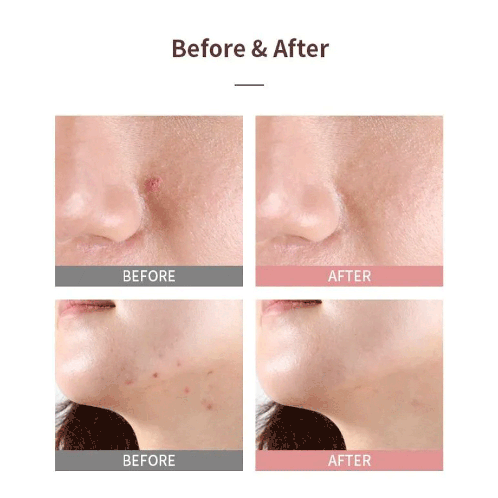 MIZON Good Bye Blemish Pink Spot 19ml - KLO