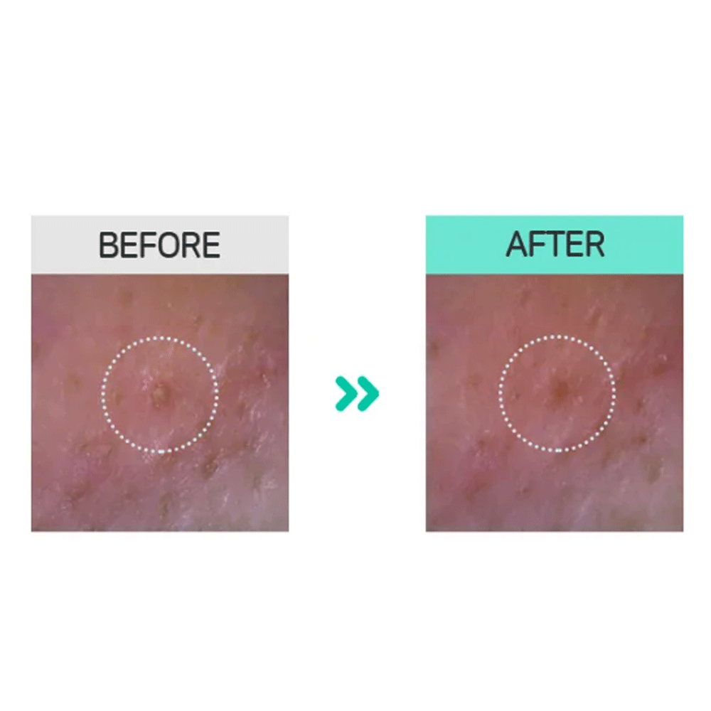 BRING GREEN Bamboo Charcoal Pore & Black Head Facial Pack 110g - KLO