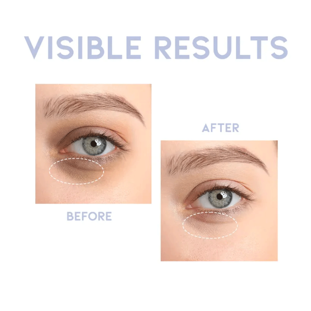 OOTD Intensive Eye Serum A.M 30g - KLO