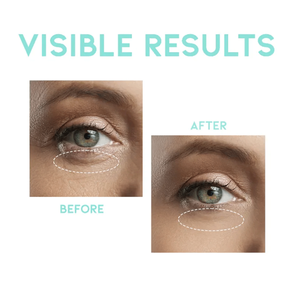 OOTD Wrinkle Lift Eye Serum 30g - KLO
