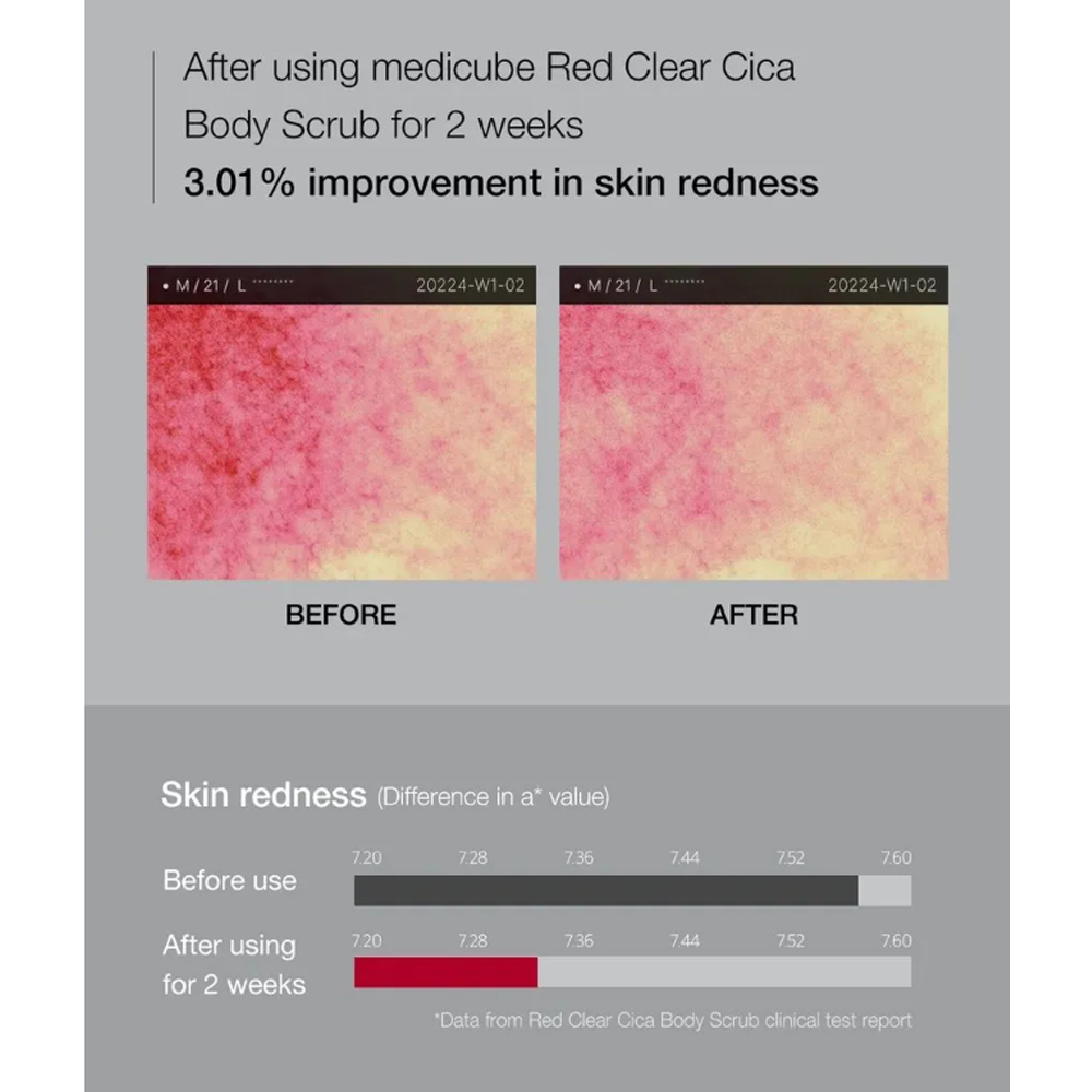 MEDICUBE Red Clear Cica Body Scrub 200g - DODOSKIN