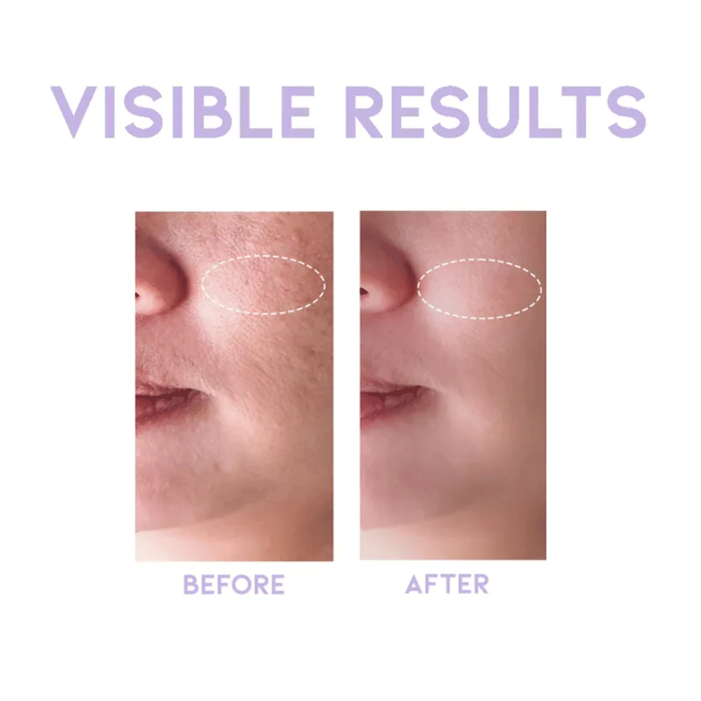 OOTD Glycolic Exfoliating Toner P.M 250ml - KLO