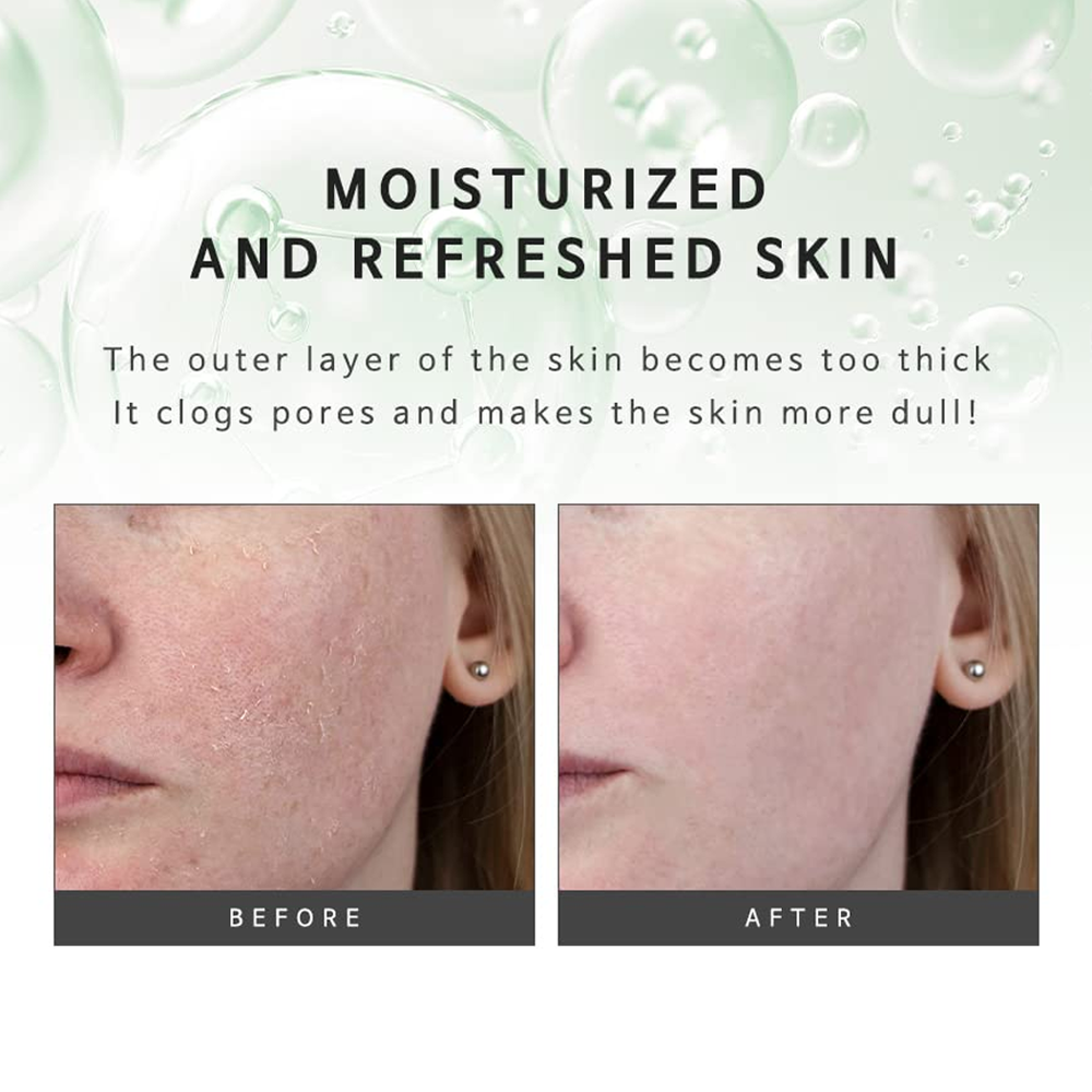 KLAVUU Phytoncide Peeling Gel 80ml - KLO