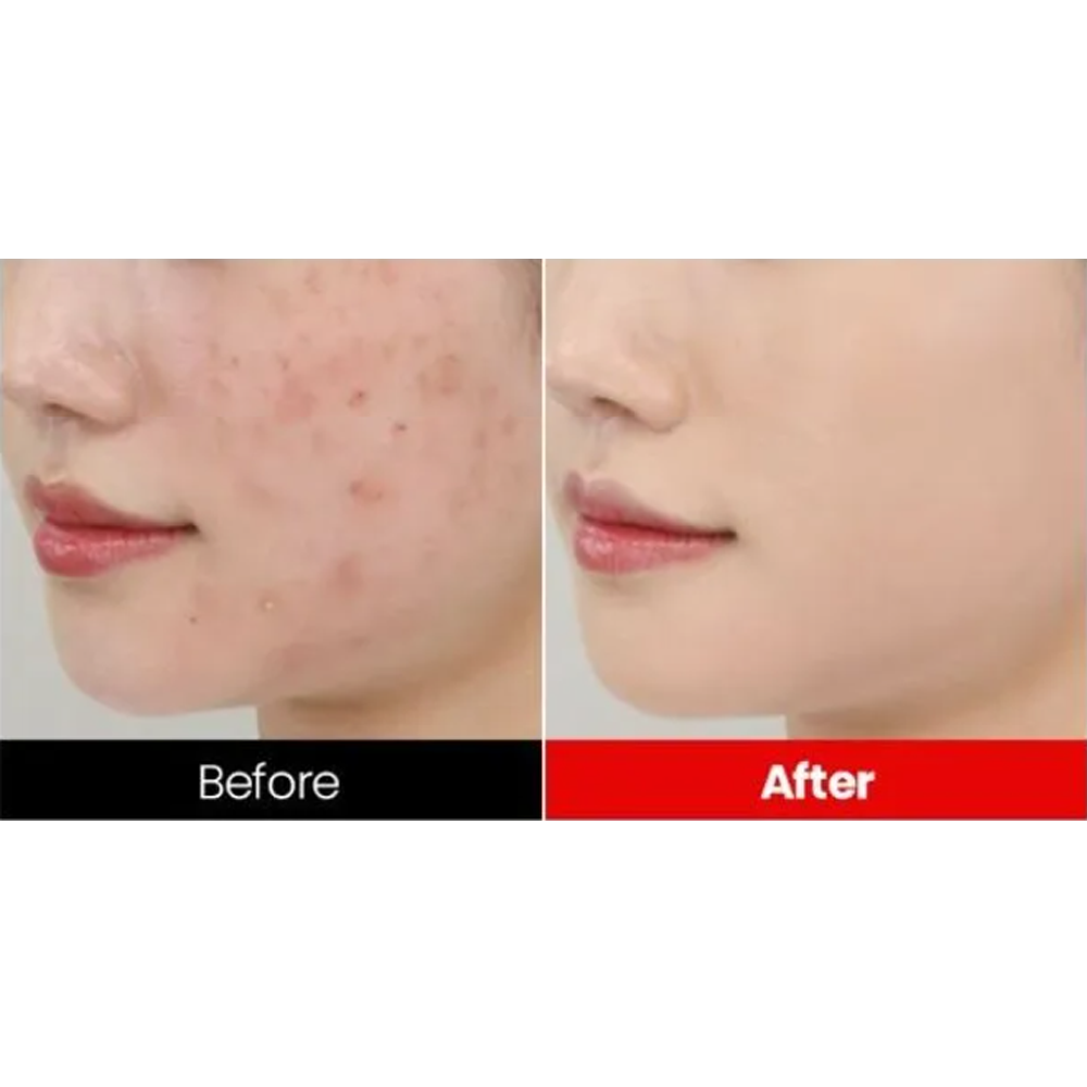 Dr.want Red Concealer 32ml - KLO