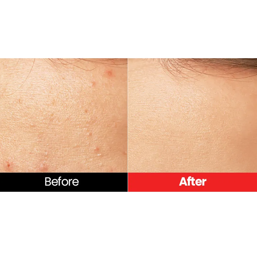 Dr.want Red Pore Pad 70 pads - KLO