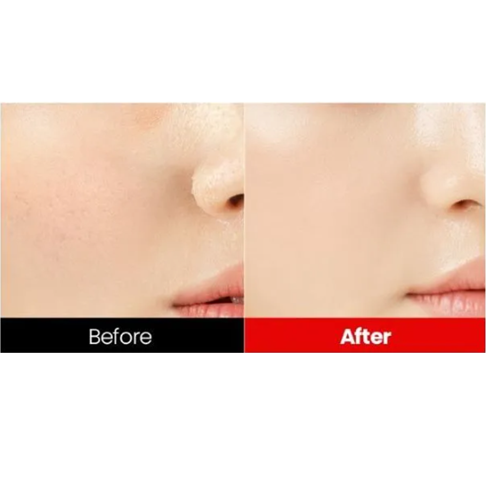 Dr.want Red BHA Gel 100g - KLO