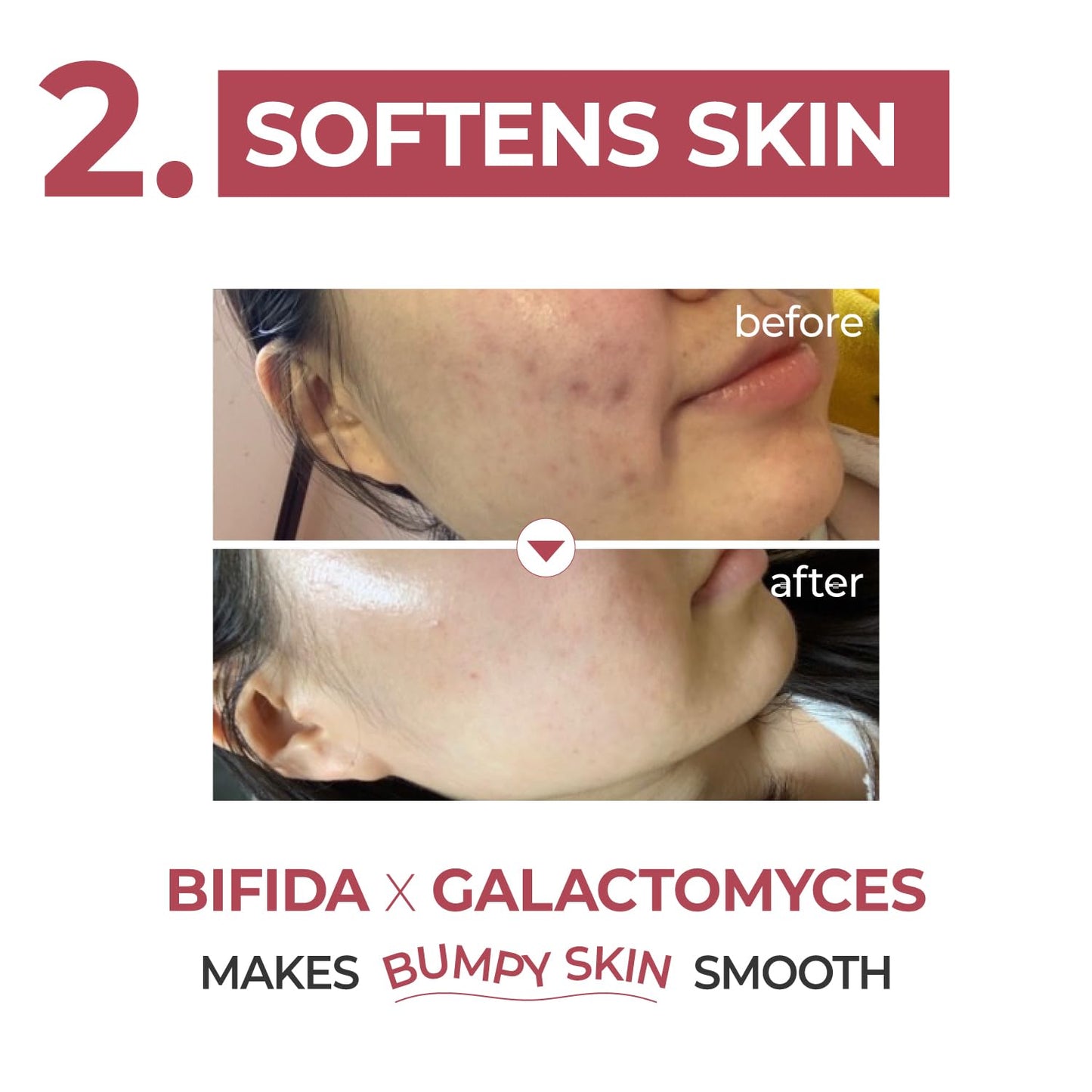 numbuzin No.3 Skin Softening Serum 50ml - DODOSKIN