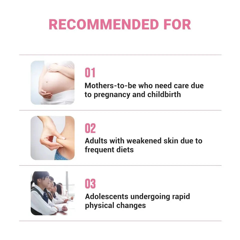 ATOPALM Maternity Care Stretch Mark Cream 150ml - KLO
