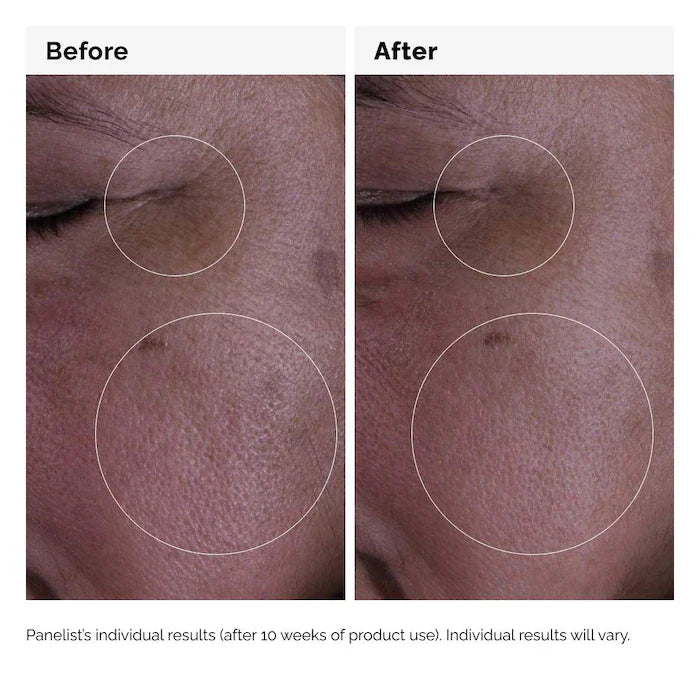 The Ordinary GF 15% Solution 30ml