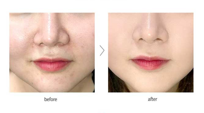 SWANICOCO Oil Cut Cusion (+Refill, Puff) - KLO