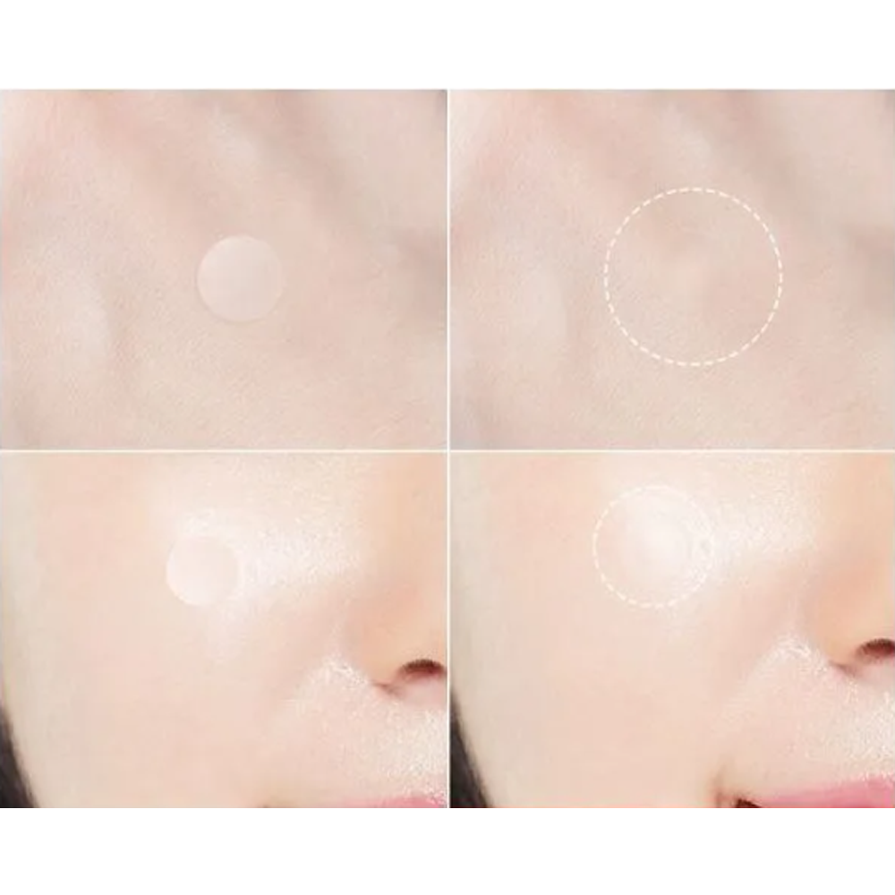 Dr.want Red Spot Patch 66 pcs - DODOSKIN