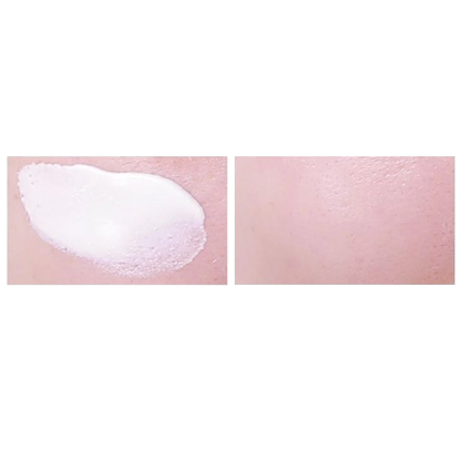 TOSOWOONG SOS Repair Cica Clinic Zinc Oxide 10% Cream 50g - DODOSKIN