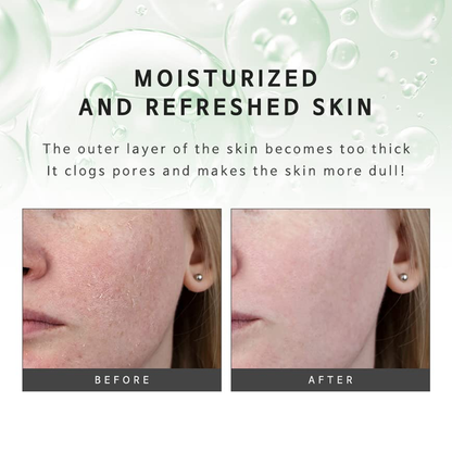 KLAVUU Phytoncide Peeling Gel 80ml - DODOSKIN