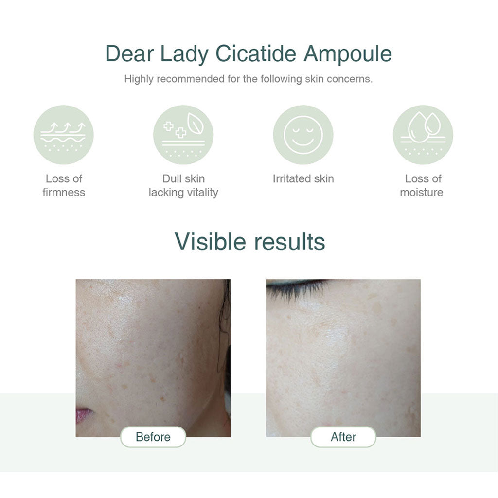 Dermamular Dear Lady Cicatide Ampoule 30ml - Dodoskin