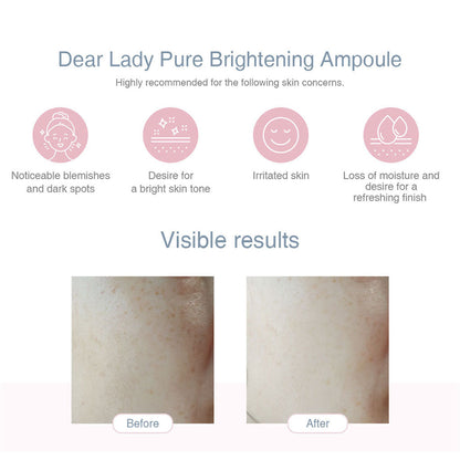 Dermamular Dear Lady Pure Brightening Ampoule 30ml - Dodoskin