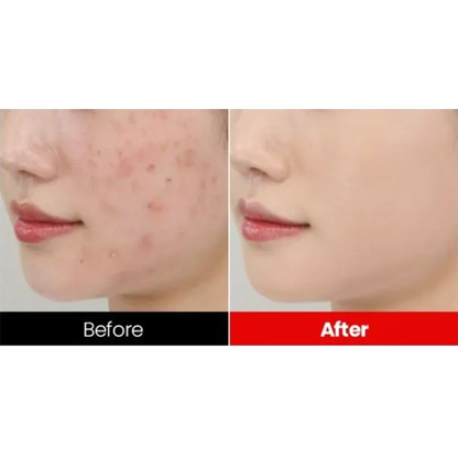 Dr.want Red Concealer 32ml - DODOSKIN