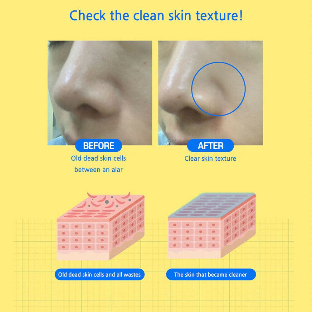 Cossgmossg Pore Bubble Cleansing Pack - KLO