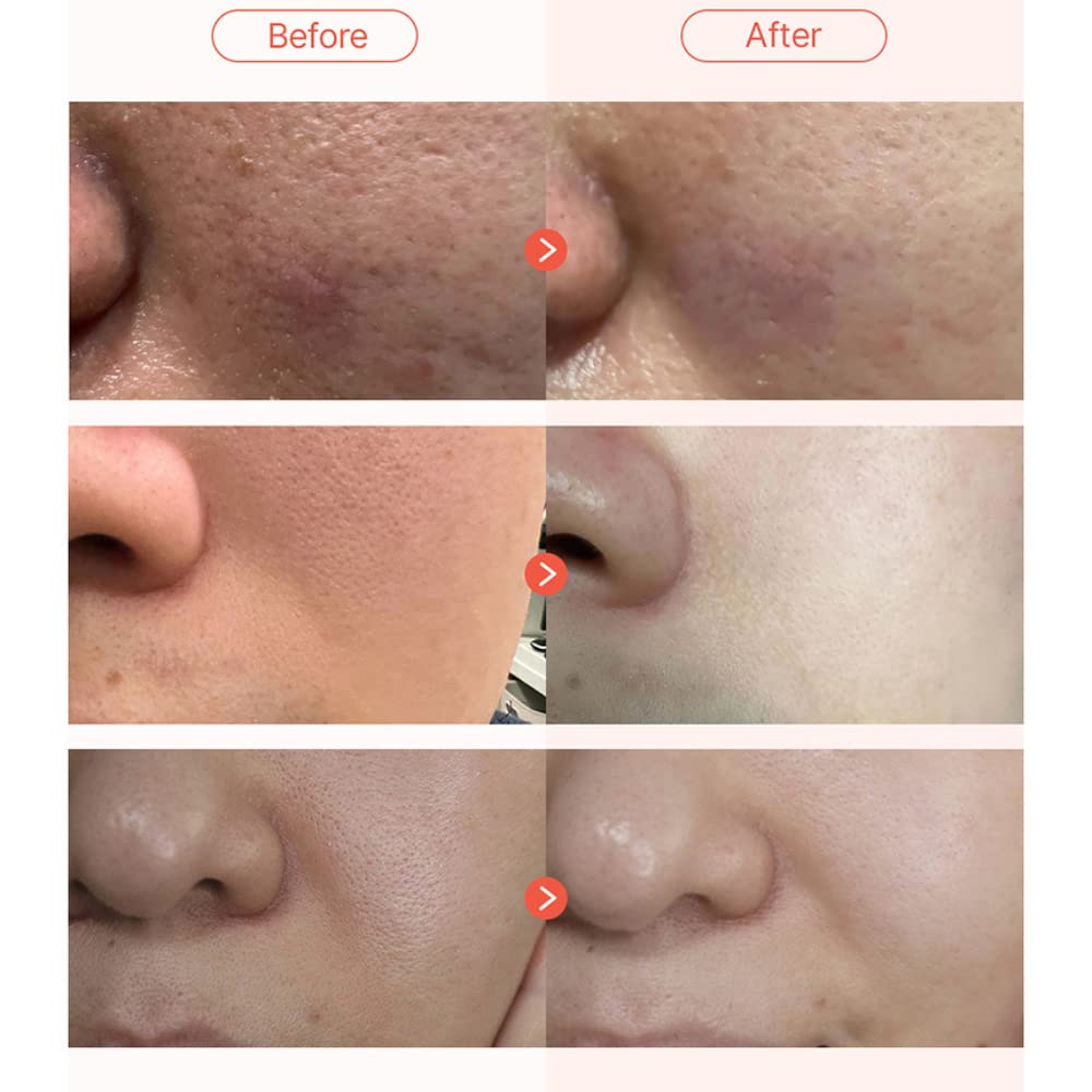 Parnell Apple Vinegar Pore Pad 60 pads - DODOSKIN