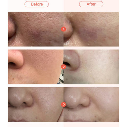 Parnell Apple Vinegar Pore Pad 60 pads - DODOSKIN