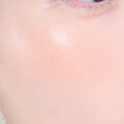 Suitable for all skin types, including dry, oily, and combination skin.